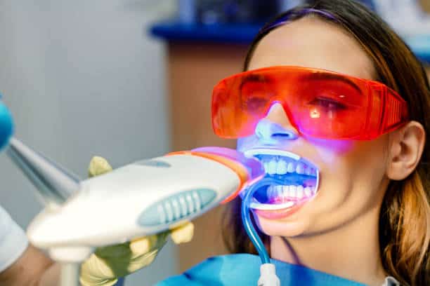 Simplifying Teeth Whitening: A Comprehensive Guide Luton