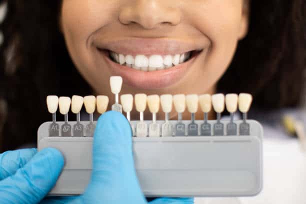 Laser Teeth Whitening: Exploring the Longevity of Your Brighter Smile Luton