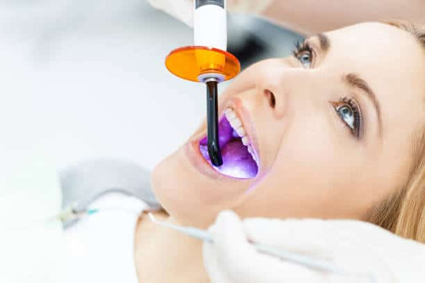 Unveiling the Cost of Laser Teeth Whitening in the UK Luton