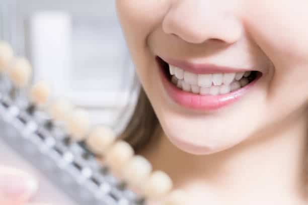 Teeth Whitening Kings Norton Luton