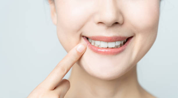 Comparing the Pain Factor: Laser Teeth Whitening vs. Zoom Teeth Whitening Luton