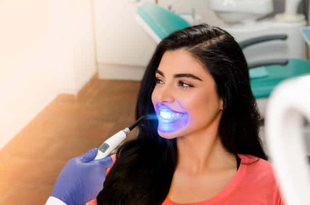 Top Teeth Whitening Systems for a Brighter Smile Luton