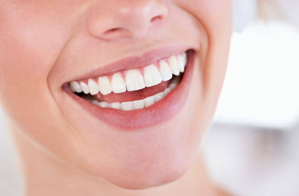 Teeth Whitening West Drayton Luton